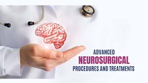 Advanced Neurosurgery at Livasa Mohali - Cutting-Edge Procedures